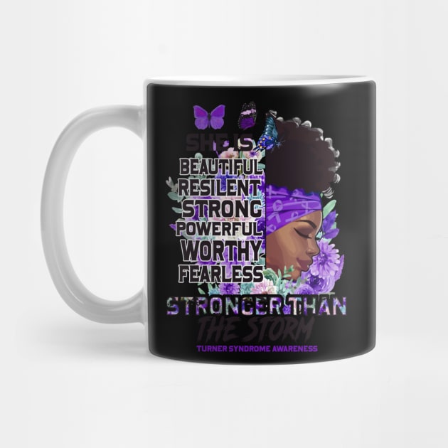 Turner Syndrome awareness black girl she is beautiful stronger than storm Support Gift by Benjie Barrett